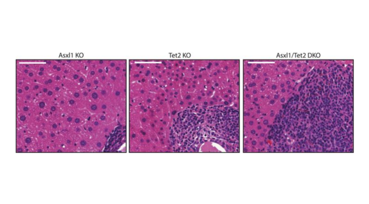Deletion of asxl1 results in myelodysplasia and severe developmental defects in vivo